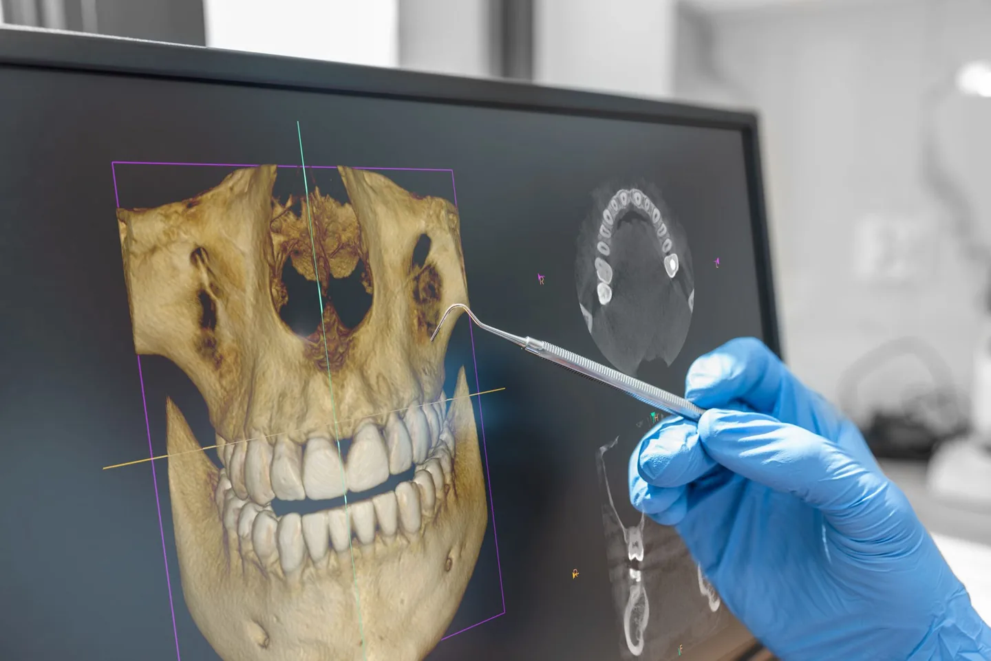 Como o domínio do fluxo digital da tomografia ajuda o dentista a comunicar melhor, gerar valor e converter mais tratamentos