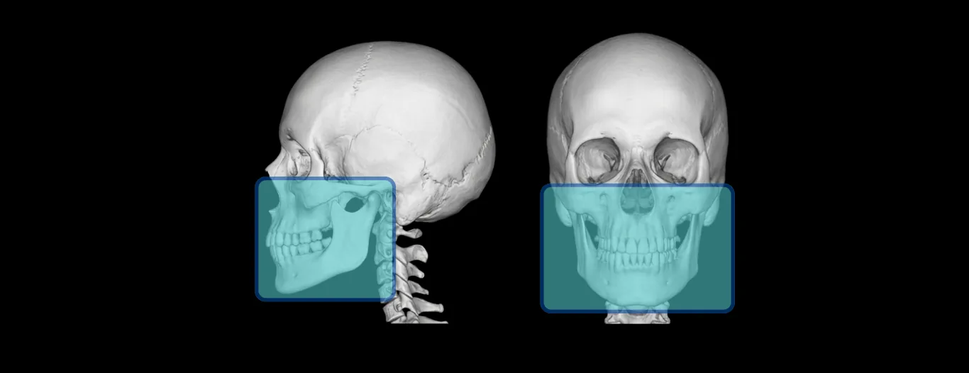 A Importância do FOV na Tomografia Odontológica