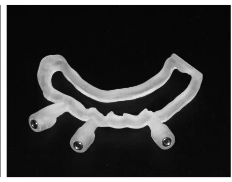 Guia de osteotomia