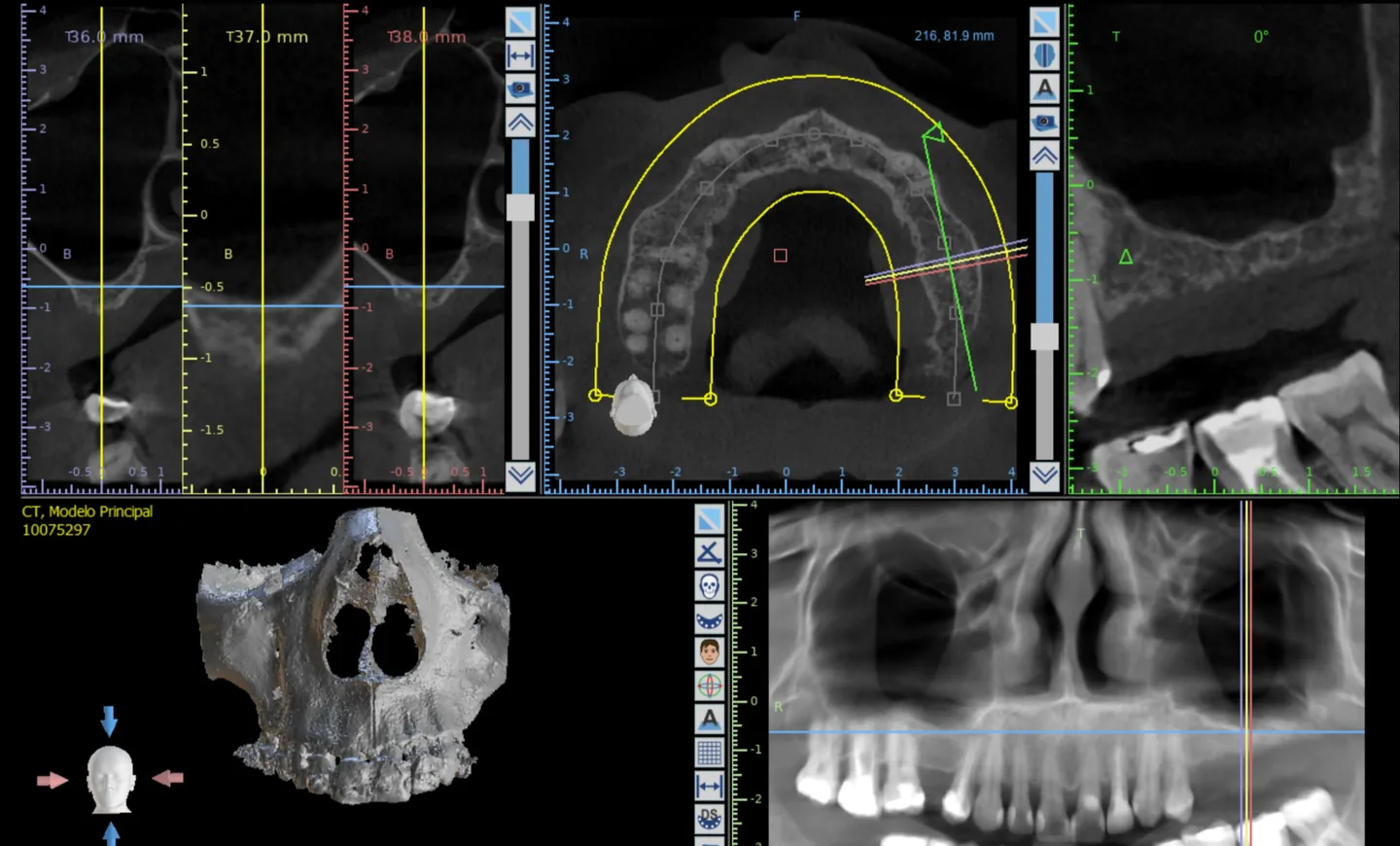 Planejamento com tomografia