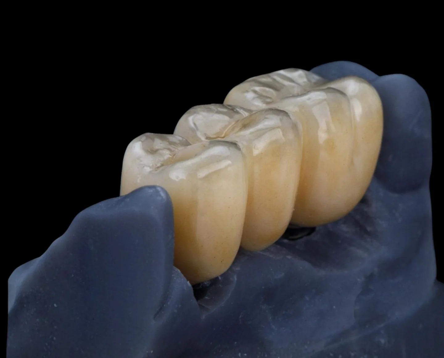 Impressão 3D na Odontologia: Guia Completo de Aplicações