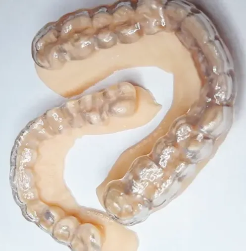 Placas de bruxismo impressas em 3D