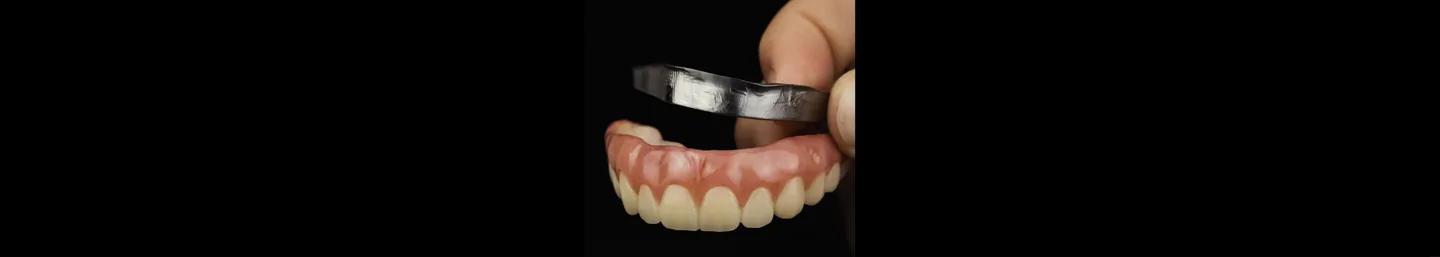 O novo fluxo digital da prótese sobre implantes: mais previsibilidade, menos etapas clínicas