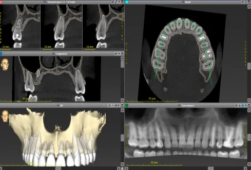 Como solicitar uma tomografia odontológica corretamente