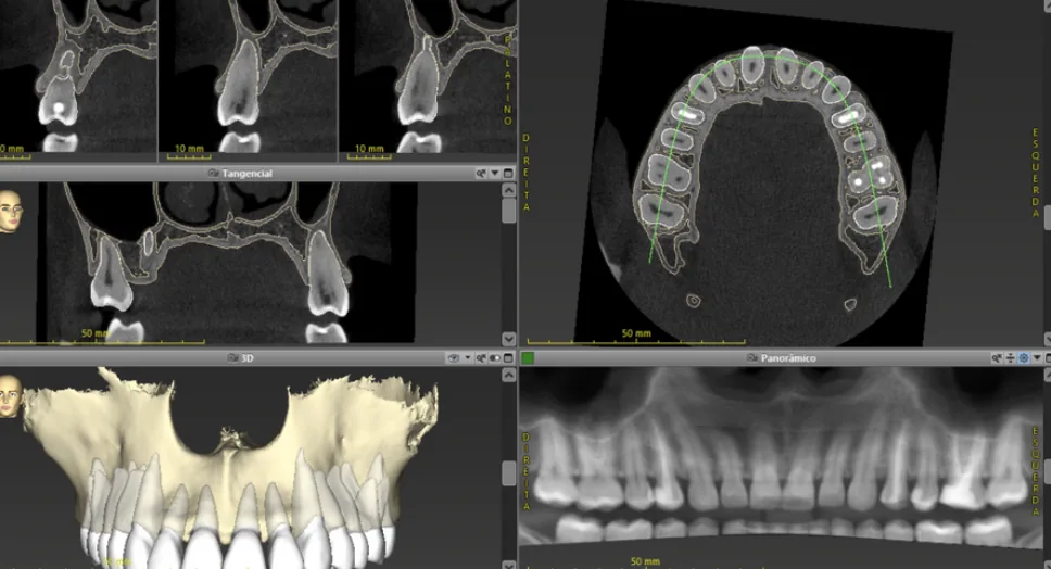 Visualização completa de tomografia odontológica com cortes e reconstrução panorâmica