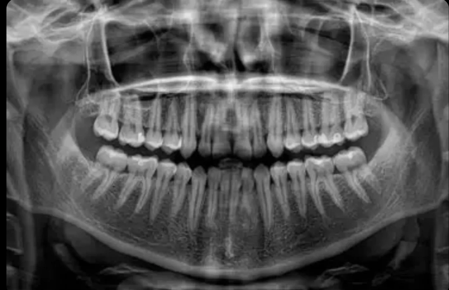 Radiografia panorâmica odontológica