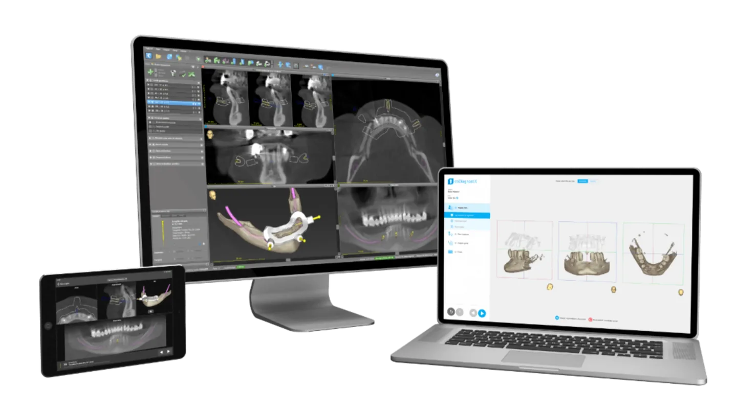 Planejamento digital integrado com tomografia