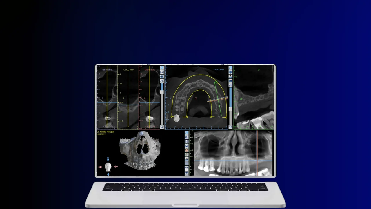 Masterclass Cirurgia Guiada