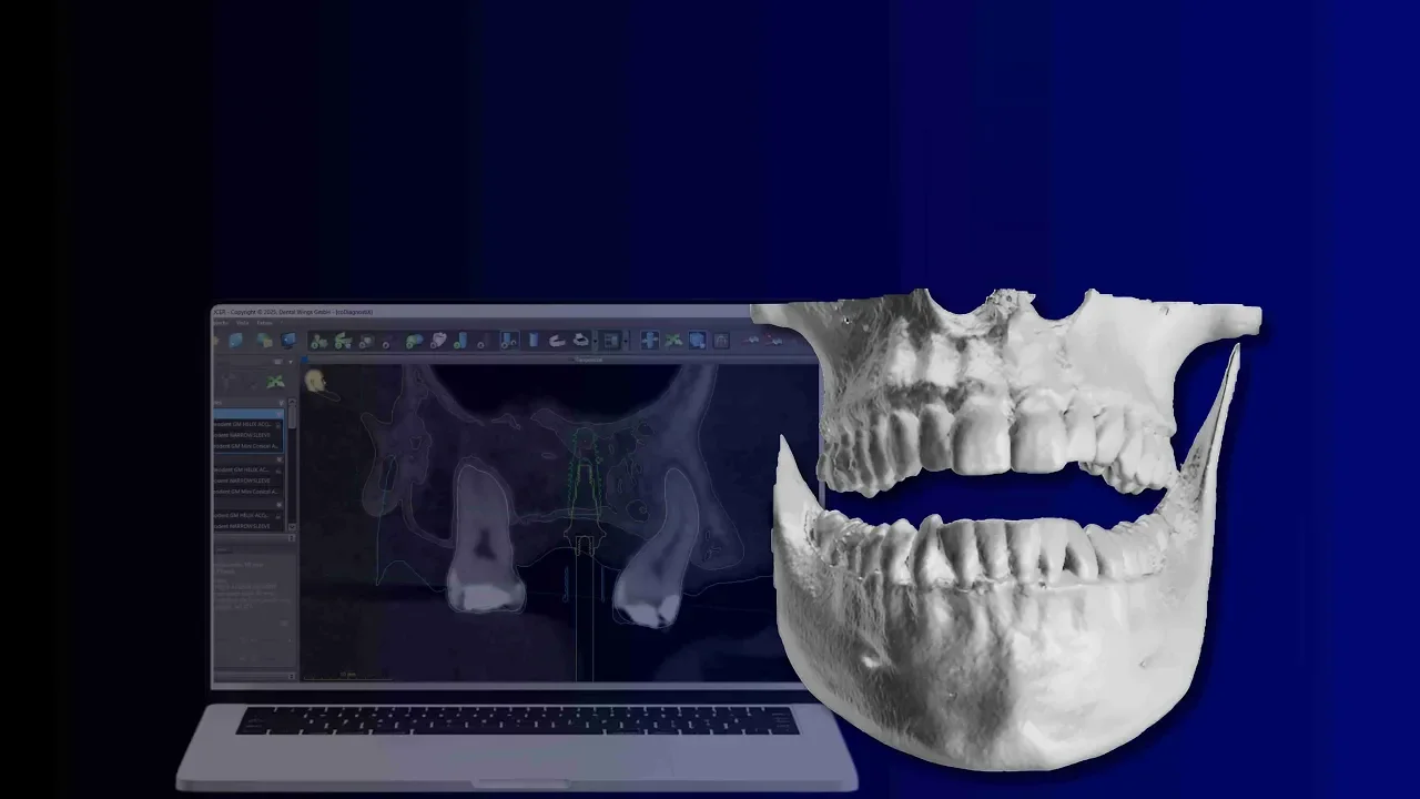 Guided Surgery Academy