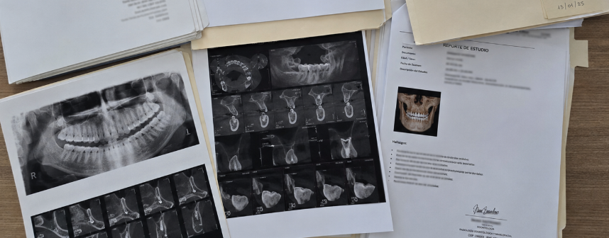 Como ler um laudo de tomografia e identificar o que ele não está dizendo