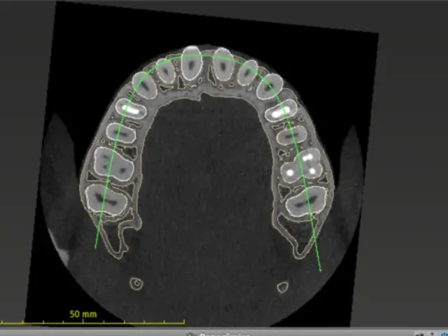 Corte axial